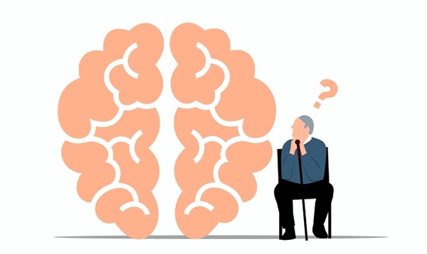 Alzheimers